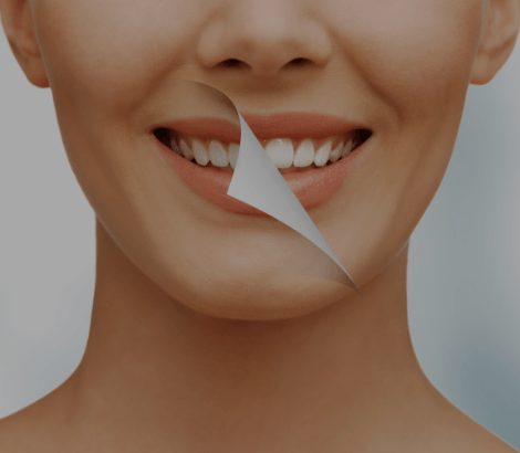 Cosmetic Dentistry | Dental on 8th | SE Calgary | General and Family Dentist
