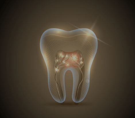 Root Canal Therapy | Dental on 8th | SE Calgary | General and Family Dentist