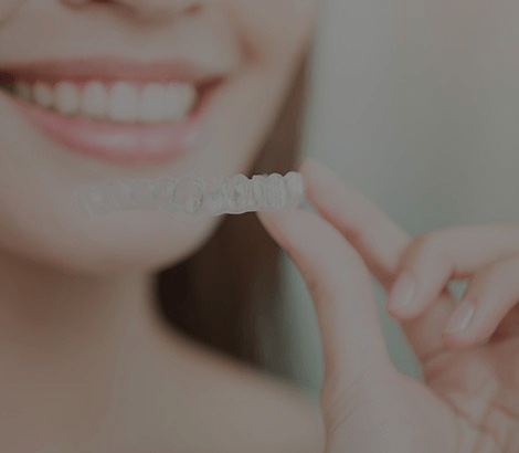 SureSmile Aligners | Dental on 8th | SE Calgary | General and Family Dentist